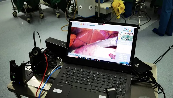 Dao bấm phẫu thuật cak tỏa sáng trong sáu ca phẫu thuật trực tiếp trên khắp Trung Quốc